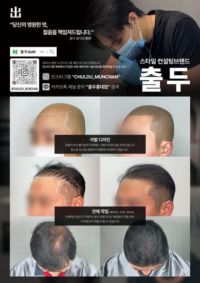 출두 두피문신 SMP 시술 과정 안내 1